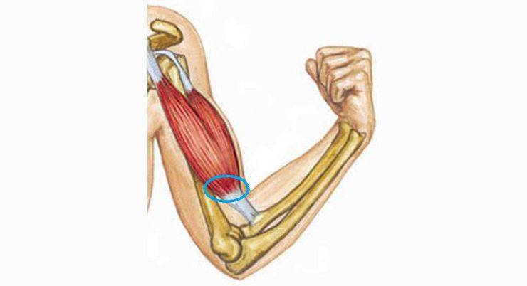 Боль после тренировок - Stone Forest